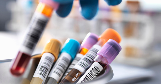 Why Straight Up Performance is Different: A Scientist's Perspective